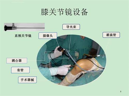 關節鏡下無源手術器械產品注冊審查指導原則（2021年第102號）(圖1)